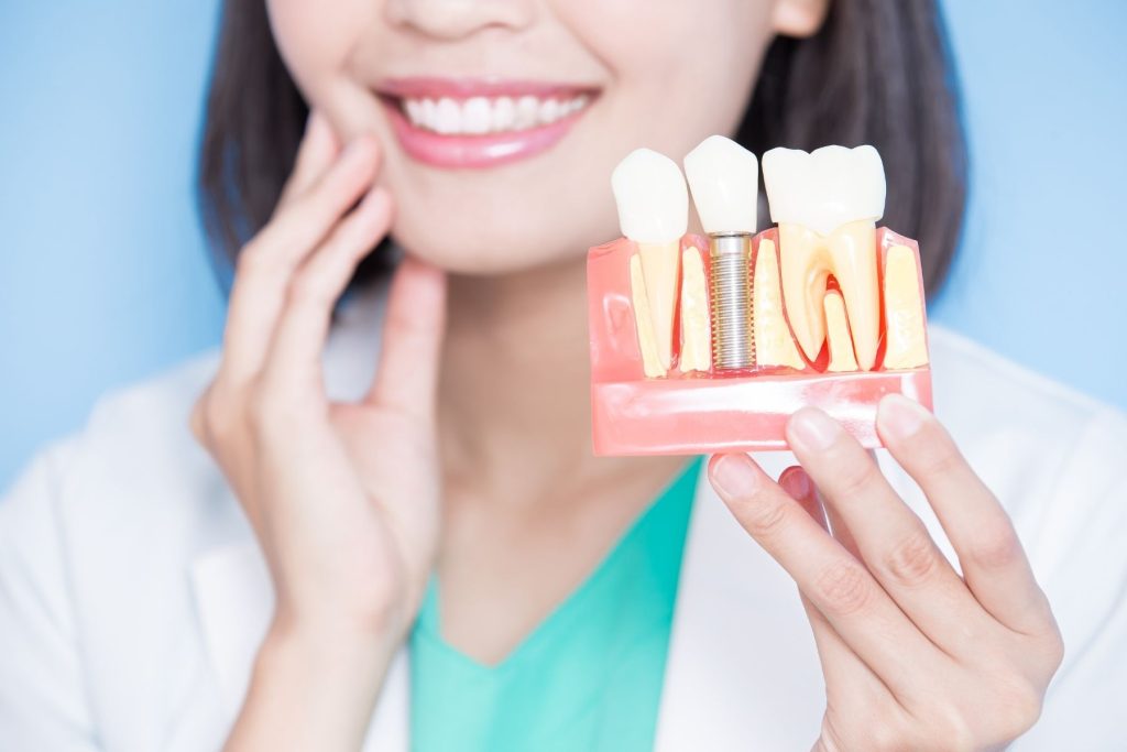 Implante Dental en una Sola Sesión en Juliaca: Recupera tu Sonrisa Rápidamente