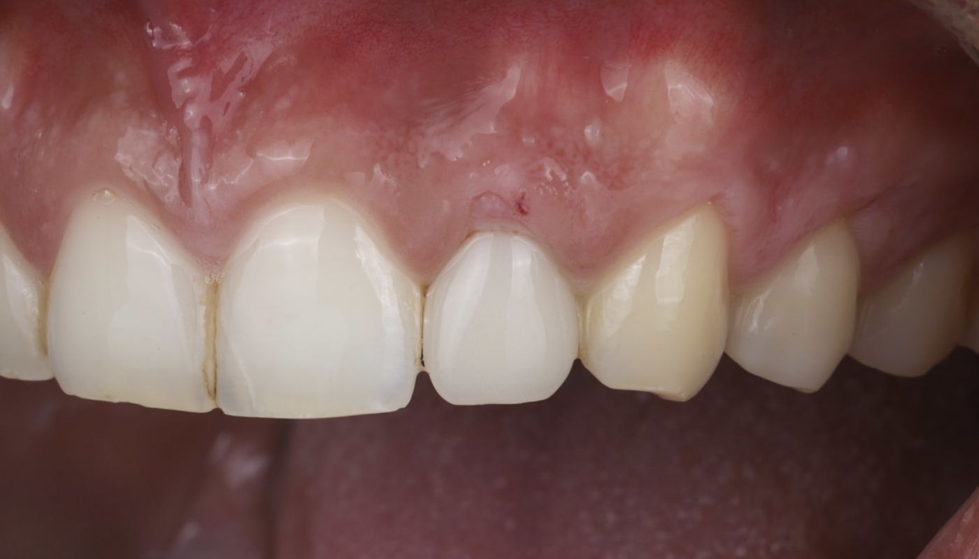 antes y despues (2)