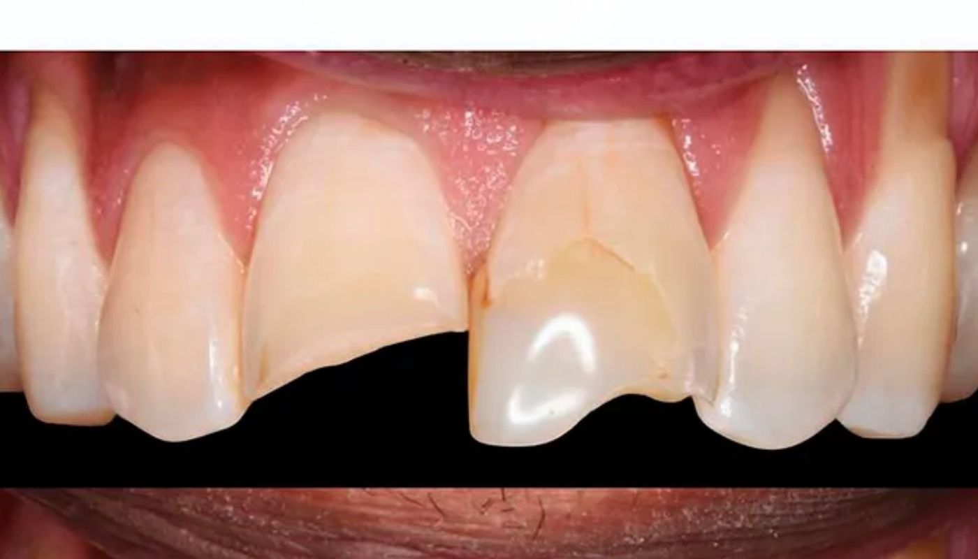 antes y despues